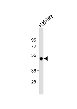KCNJ15 Antibody (C-term)