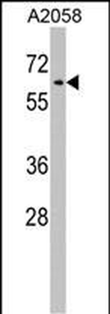 RIC8A Antibody (Center)