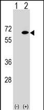 EYA2 Antibody (Center)