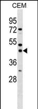 SSBP3 Antibody (Center)