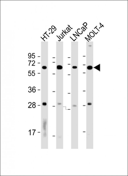 RCOR1 Antibody (N-term)