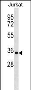 HNRNPA1 Antibody (C-term)