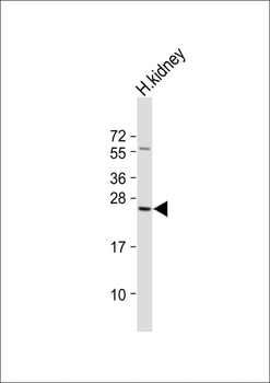 RAB28 Antibody (Center)