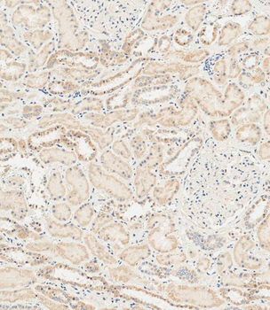 RAB28 Antibody (Center)