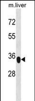 YIPF3 Antibody (C-term)