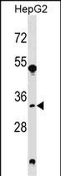 SRM Antibody (Center)