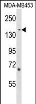 ARHGEF11 Antibody (Center)
