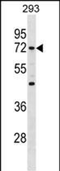 Mouse Camkk1 Antibody (C-term)