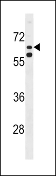 KLHL38 Antibody (N-term)