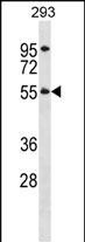 TTC8 Antibody (N-term)