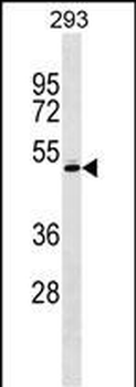 RCBTB1 Antibody (Center)