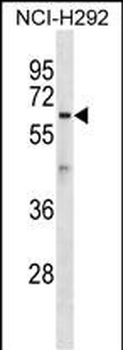 ATL1 Antibody (C-term)