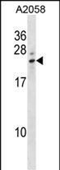LCN8 Antibody (C-term)