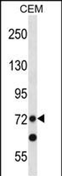 PRDM8 Antibody (N-term)