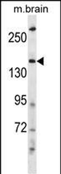 HECW2 Antibody (Center)