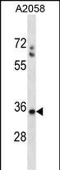 SPEM1 Antibody (Center)
