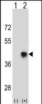 SPEM1 Antibody (Center)