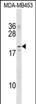 NKAIN2 Antibody (Center)