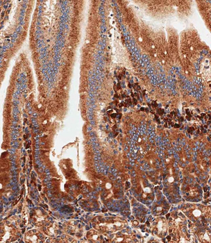 Mouse Nlrp6 Antibody (Center)