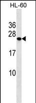 PCTP Antibody (Center)