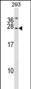 SYNGR2 Antibody (N-term)