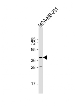 TAS2R31 Antibody (C-term)