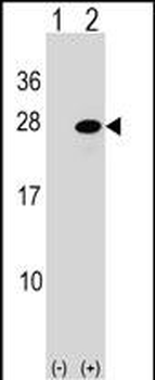 ATF3 Antibody (C-term)