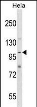 SH3PXD2A Antibody (N-term)