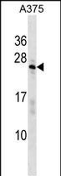 SARNP Antibody (Center)