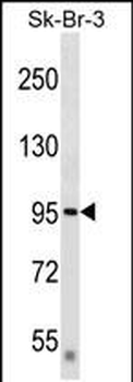 DTX3L Antibody (Center)
