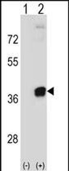 PRPS2 Antibody (Center)