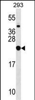 RPL9 Antibody (C-term)