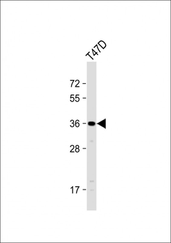 OR4D11 Antibody (C-term)
