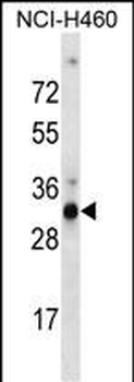 OR9G4 Antibody (C-term)