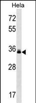 LMAN2 Antibody (C-term)