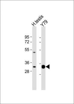 ELOVL4 Antibody (C-term)