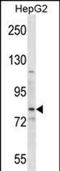 SMO Antibody (Center)