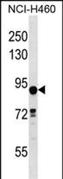 DLEC1 Antibody (N-term)