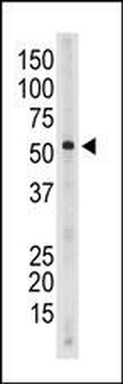 SIGLEC6 Antibody (C-term)