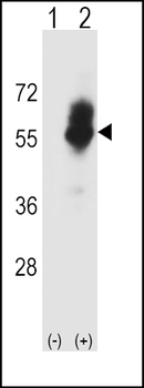 SLC7A1 Antibody (C-term)