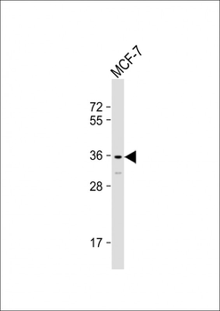 OR2T11 Antibody (C-term)
