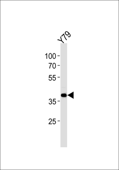 SIX3 Antibody (Center)
