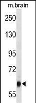 VPS45 Antibody (C-term)