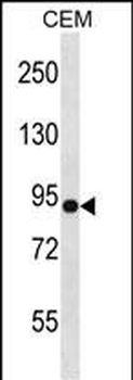 NLGN4Y Antibody (N-term)