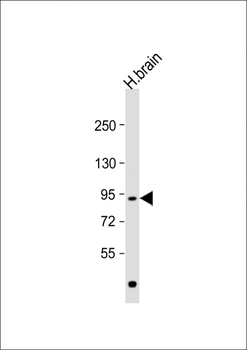 NLGN4Y Antibody (N-term)