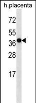 OR5H2 Antibody (C-term)