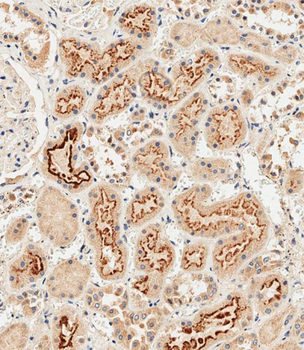 GIPC1 Antibody (N-term)