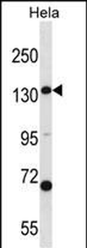 CPS1 Antibody (N-term)