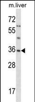 SGTA Antibody (Center)
