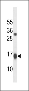 GATE16 Antibody (N-term)